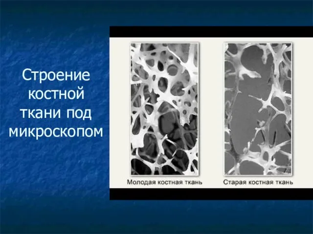 Строение костной ткани под микроскопом