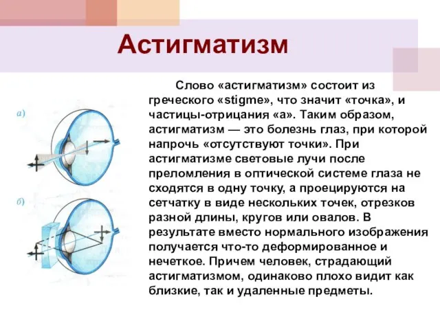 Астигматизм Слово «астигматизм» состоит из греческого «stigme», что значит «точка», и частицы-отрицания