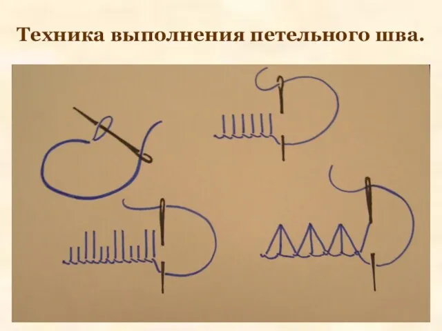 Техника выполнения петельного шва.