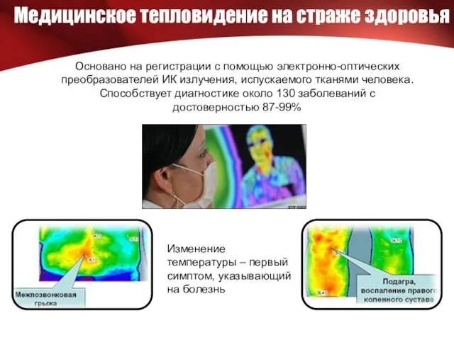 Медицинское тепловидение на страже здоровья Основано на регистрации с помощью электронно-оптических преобразователей