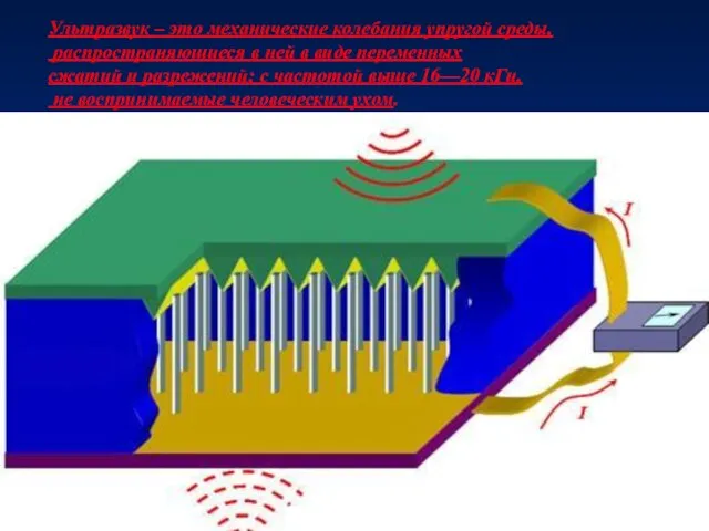 Ультразвук – это механические колебания упругой среды, распространяющиеся в ней в виде