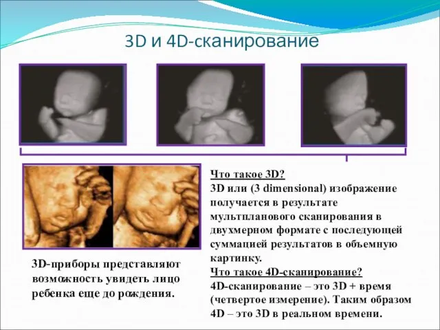 3D и 4D-cканирование Что такое 3D? 3D или (3 dimensional) изображение получается