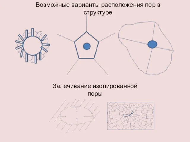 Возможные варианты расположения пор в структуре Залечивание изолированной поры