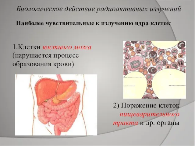 Наиболее чувствительные к излучению ядра клеток 1.Клетки костного мозга (нарушается процесс образования