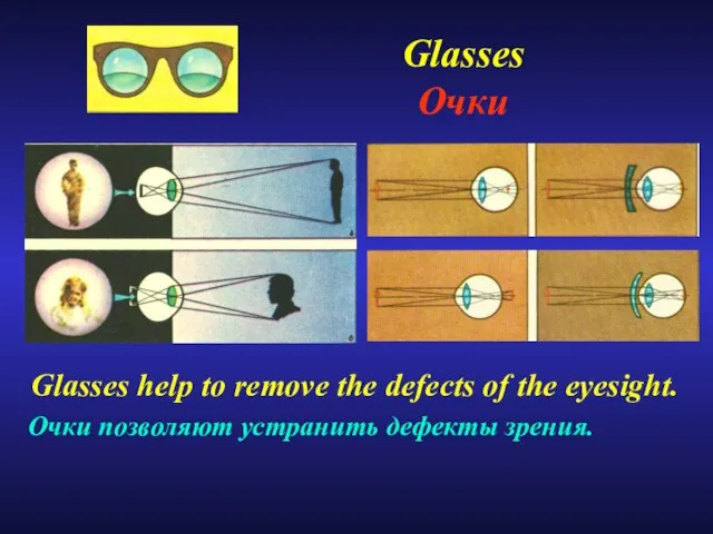 Glasses Очки Glasses help to remove the defects of the eyesight. Очки позволяют устранить дефекты зрения.