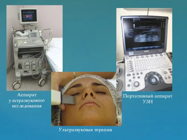 Аппарат ультразвукового исследования Ультразвуковая терапия Портативный аппарат УЗИ