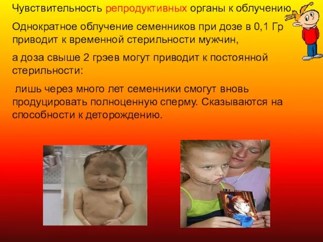 Чувствительность репродуктивных органы к облучению. Однократное облучение семенников при дозе в 0,1