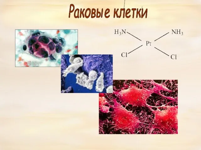 Раковые клетки