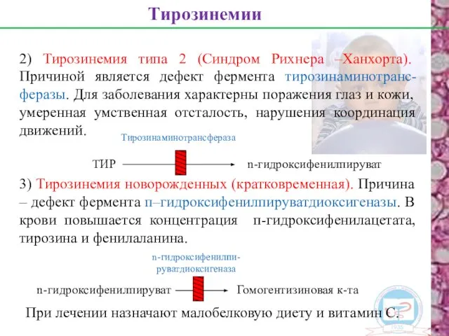 2) Тирозинемия типа 2 (Синдром Рихнера –Ханхорта). Причиной является дефект фермента тирозинаминотранс-феразы.