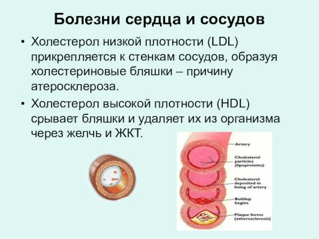 Болезни сердца и сосудов Холестерол низкой плотности (LDL) прикрепляется к стенкам сосудов,