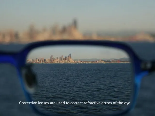 Corrective lenses are used to correct refractive errors of the eye.