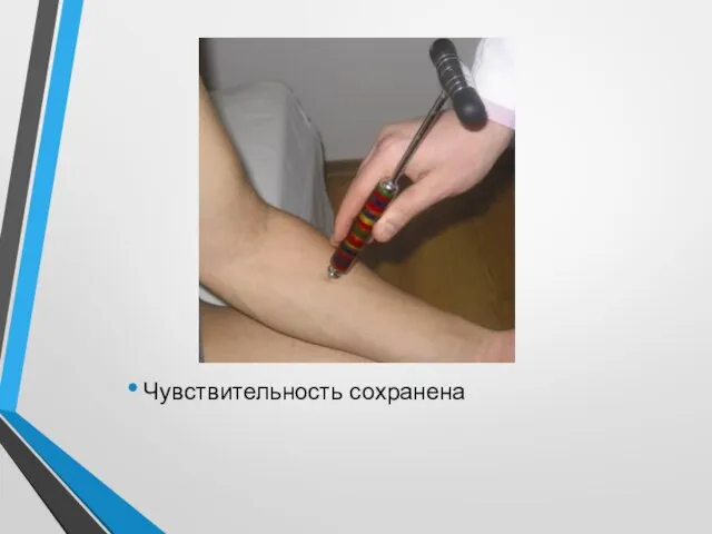 Чувствительность сохранена