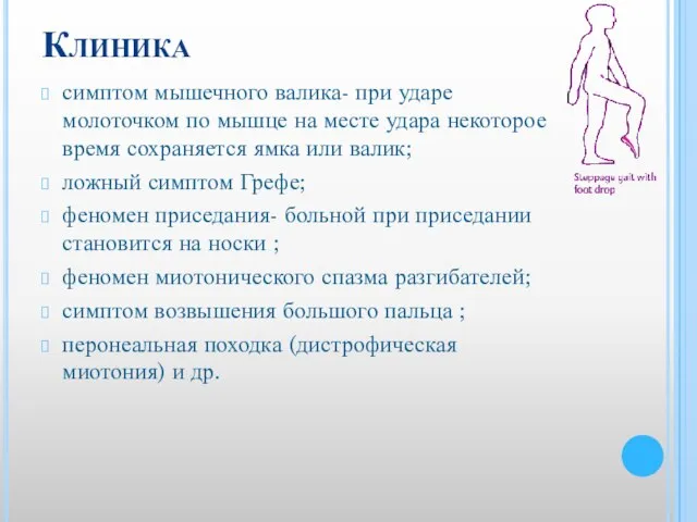 Клиника симптом мышечного валика- при ударе молоточком по мышце на месте удара