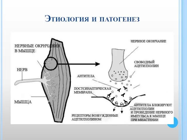 Этиология и патогенез