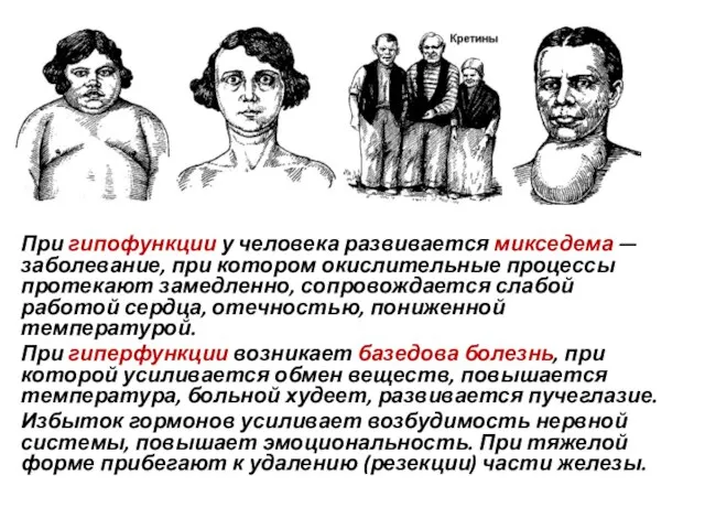 При гипофункции у человека развивается микседема — заболевание, при котором окислительные процессы