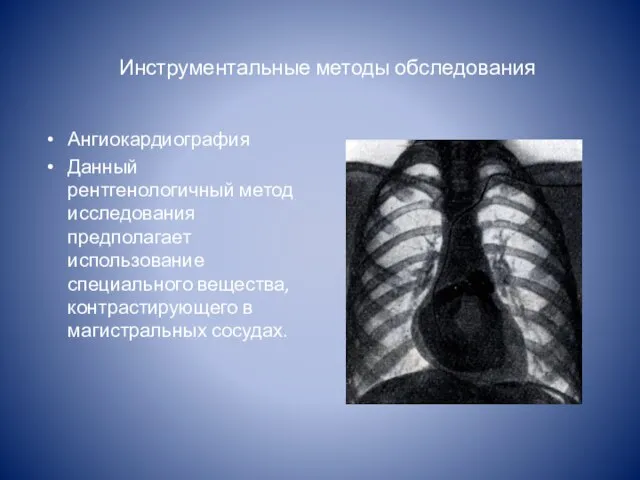 Инструментальные методы обследования Ангиокардиография Данный рентгенологичный метод исследования предполагает использование специального вещества, контрастирующего в магистральных сосудах.