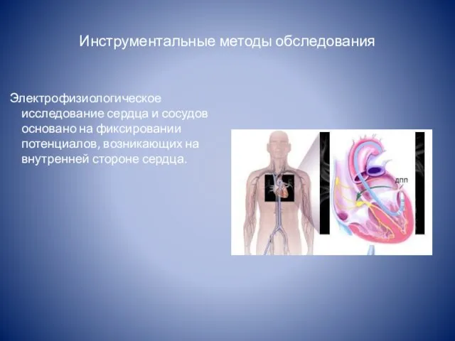 Инструментальные методы обследования Электрофизиологическое исследование сердца и сосудов основано на фиксировании потенциалов,