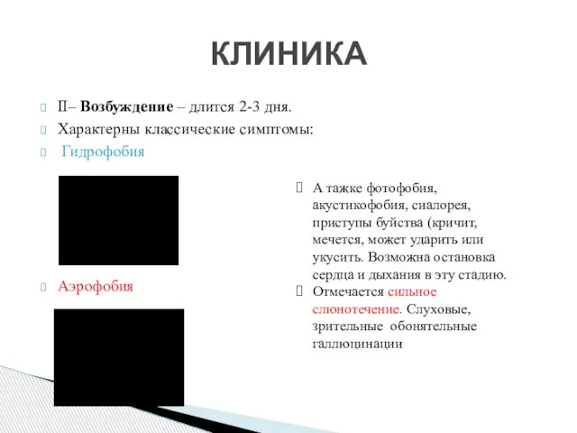 II– Возбуждение – длится 2-3 дня. Характерны классические симптомы: Гидрофобия Аэрофобия КЛИНИКА