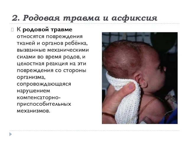 2. Родовая травма и асфиксия К родовой травме относятся повреждения тканей и