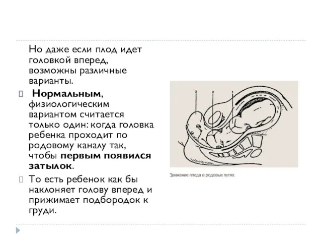 Но даже если плод идет головкой вперед, возможны различные варианты. Нормальным, физиологическим