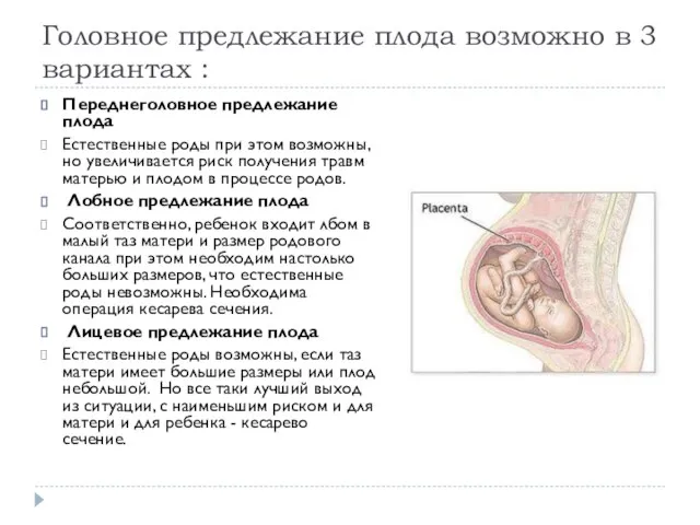 Головное предлежание плода возможно в 3 вариантах : Переднеголовное предлежание плода Естественные