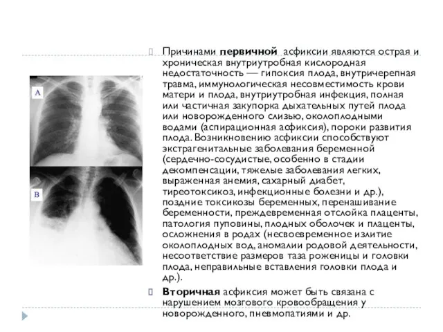 Причинами первичной асфиксии являются острая и хроническая внутриутробная кислородная недостаточность — гипоксия