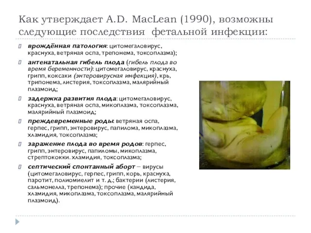 Как утверждает A.D. MacLean (1990), возможны следующие последствия фетальной инфекции: врождённая патология: