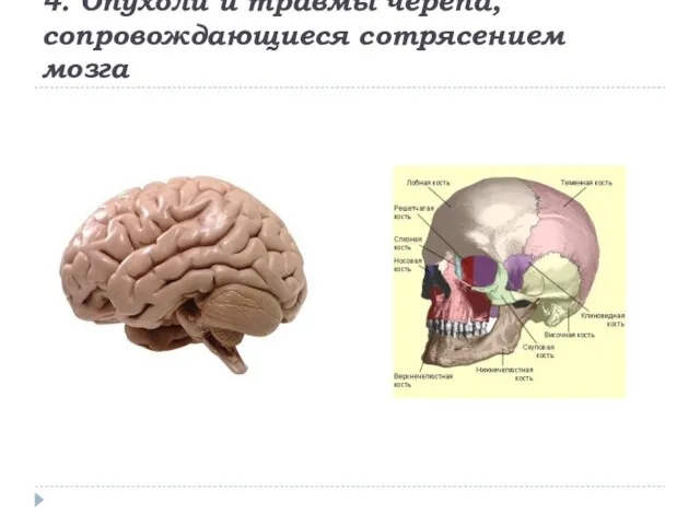4. Опухоли и травмы черепа, сопровождающиеся сотрясением мозга