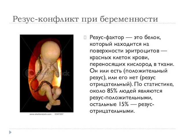 Резус-конфликт при беременности Резус-фактор — это белок, который находится на поверхности эритроцитов
