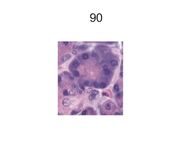 90