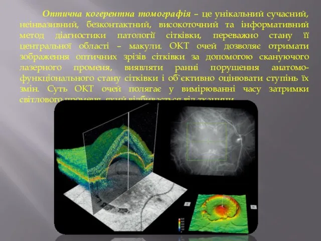 Оптична когерентна томографія – це унікальний сучасний, неінвазивний, безконтактний, високоточний та інформативний