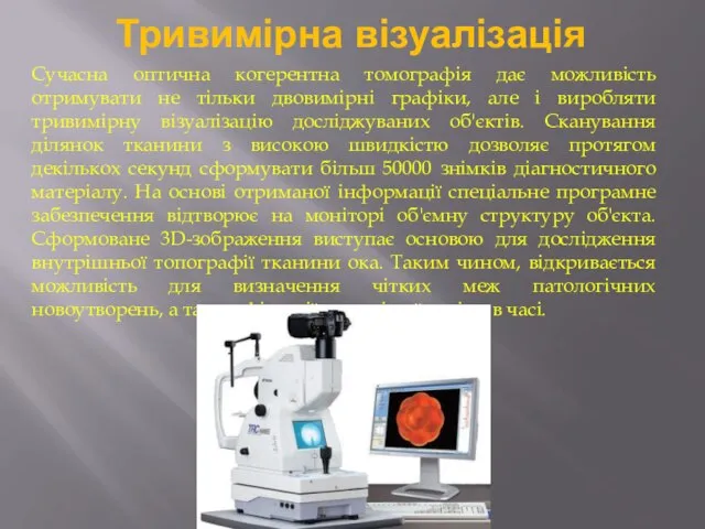 Тривимірна візуалізація Сучасна оптична когерентна томографія дає можливість отримувати не тільки двовимірні