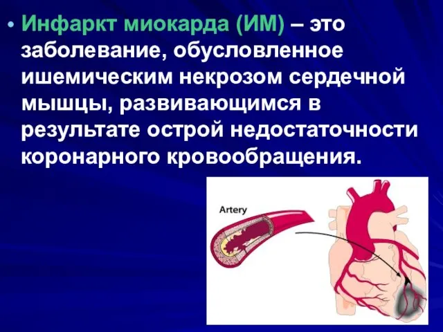 Инфаркт миокарда (ИМ) – это заболевание, обусловленное ишемическим некрозом сердечной мышцы, развивающимся