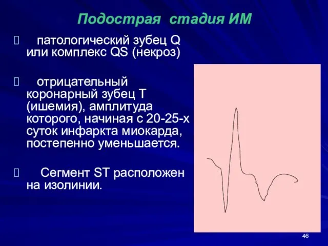 Подострая стадия ИМ патологический зубец Q или комплекс QS (некроз) отрицательный коронарный