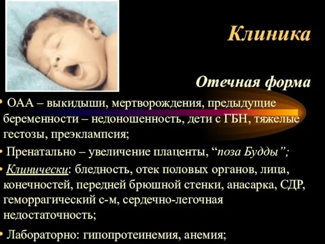 Клиника Отечная форма ОАА – выкидыши, мертворождения, предыдущие беременности – недоношенность, дети