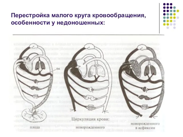 Перестройка малого круга кровообращения, особенности у недоношенных: