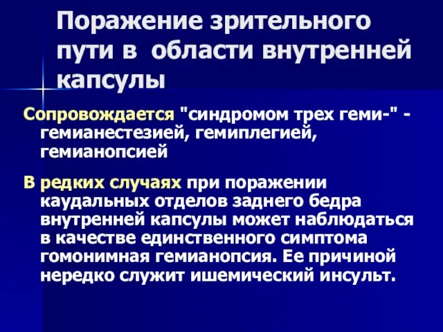 Поражение зрительного пути в области внутренней капсулы Сопровождается "синдромом трех геми-" -