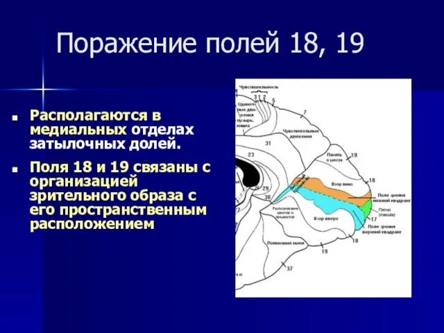 Поражение полей 18, 19 Располагаются в медиальных отделах затылочных долей. Поля 18