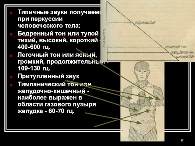 Типичные звуки получаемые при перкуссии человеческого тела: Бедренный тон или тупой -