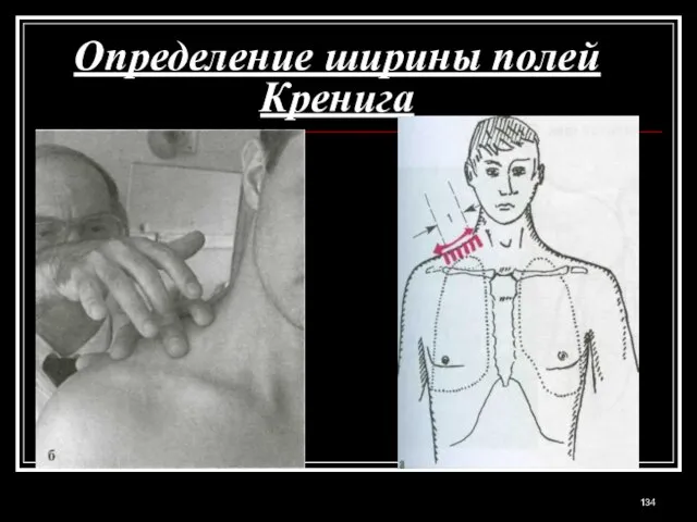 Определение ширины полей Кренига