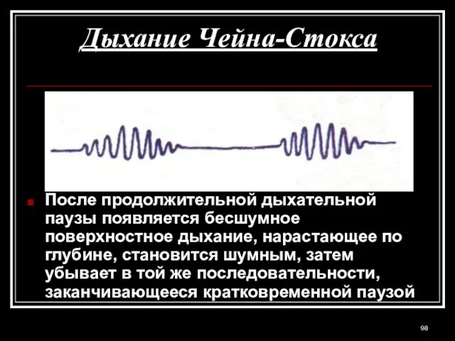 Дыхание Чейна-Стокса После продолжительной дыхательной паузы появляется бесшумное поверхностное дыхание, нарастающее по