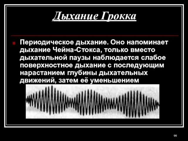 Дыхание Грокка Периодическое дыхание. Оно напоминает дыхание Чейна-Стокса, только вместо дыхательной паузы