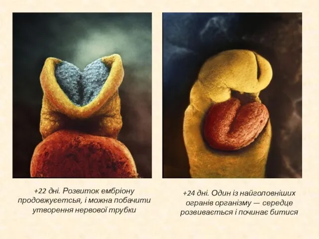 +22 дні. Розвиток ембріону продовжуєетсья, і можна побачити утворення нервової трубки +24