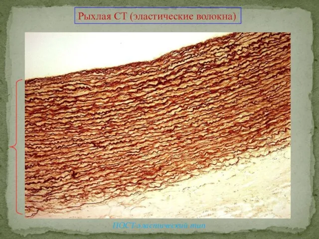 Рыхлая СТ (эластические волокна) ПОСТ-эластический тип