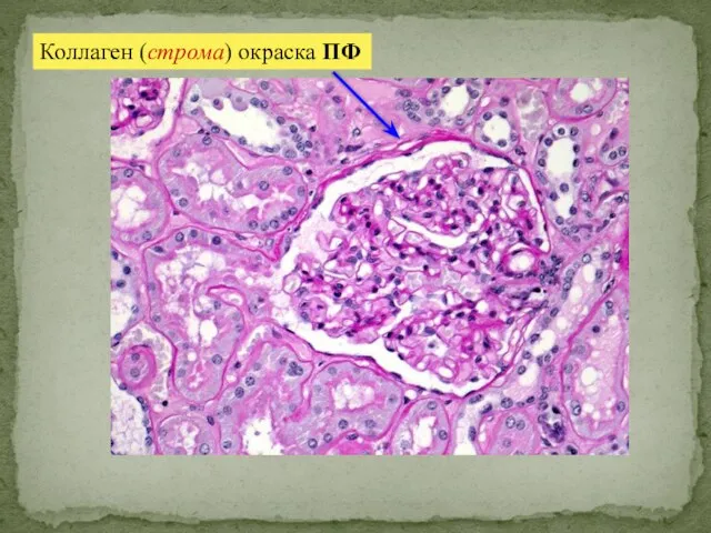 Коллаген (строма) окраска ПФ