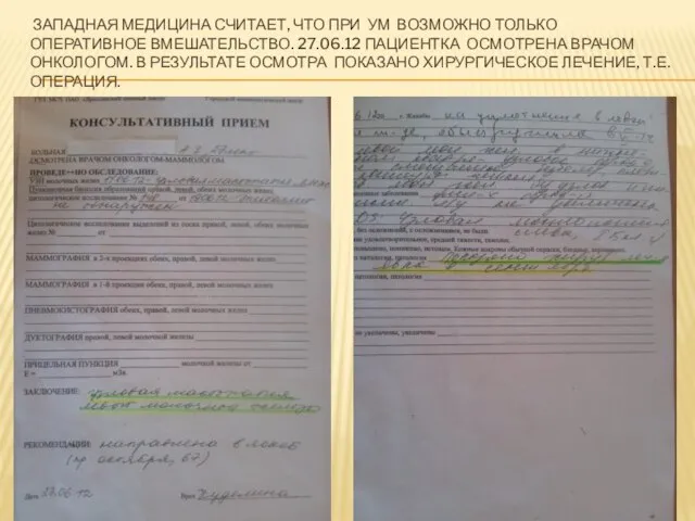 ЗАПАДНАЯ МЕДИЦИНА СЧИТАЕТ, ЧТО ПРИ УМ ВОЗМОЖНО ТОЛЬКО ОПЕРАТИВНОЕ ВМЕШАТЕЛЬСТВО. 27.06.12 ПАЦИЕНТКА