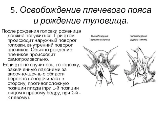 5. Освобождение плечевого пояса и рождение туловища. После рождения головки роженица должна