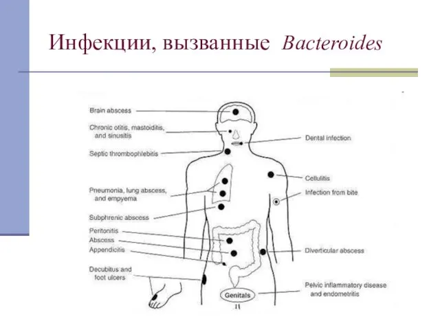 Инфекции, вызванные Bacteroides