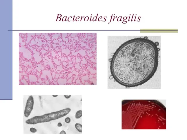 Bacteroides fragilis