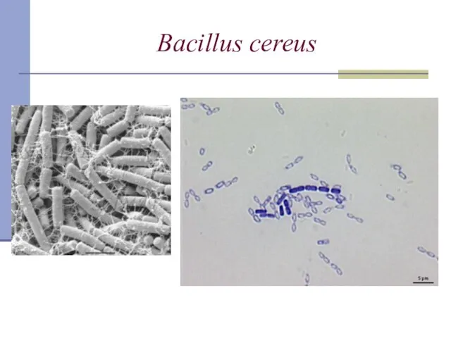 Bacillus сereus